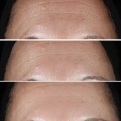 Clinique Visage^Smart