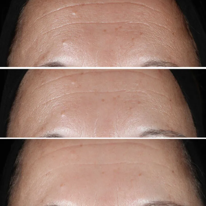 Clinique Visage^Smart