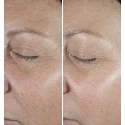 Clinique Visage^Smart