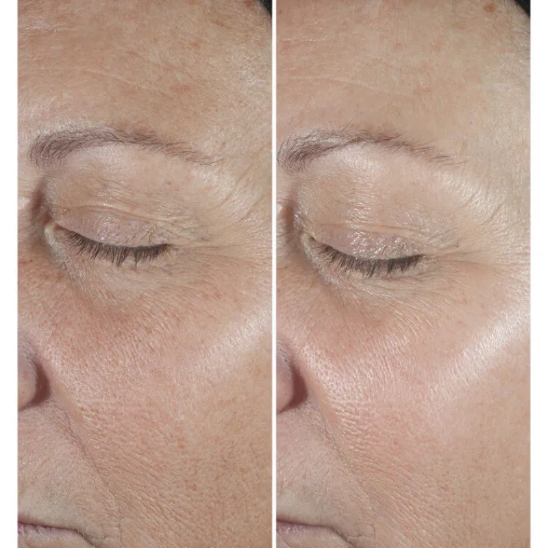 Clinique Visage^Smart