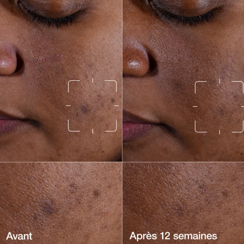 Clinique Visage^Even Better Clinical™