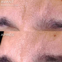 Lancôme Visage^Rénergie C.R.X. Triple Sérum Rétinol