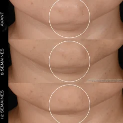 Lancôme Visage^Rénergie H.P.N. 300-Peptide