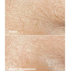 Clinique Visage^Smart Clinical Repair